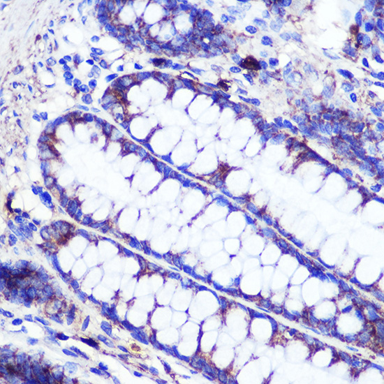 Anti-SIRT2 Antibody (CAB12575)