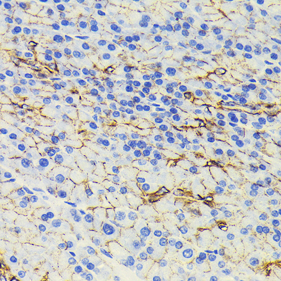 Anti-Beta-Catenin Antibody [KO Validated] (CAB19657)