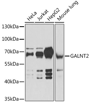 Anti-GALNT2 Antibody (CAB6910)