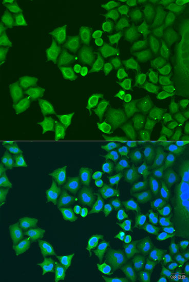 Anti-SYT4 Antibody (CAB7737)