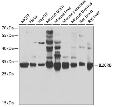 Anti-IL20RB Polyclonal Antibody (CAB7980)