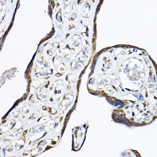 Anti-PAPD7 Antibody (CAB10017)