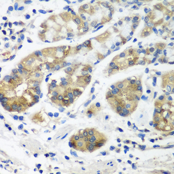 Anti-Syntaxin-16 Polyclonal Antibody (CAB8168)