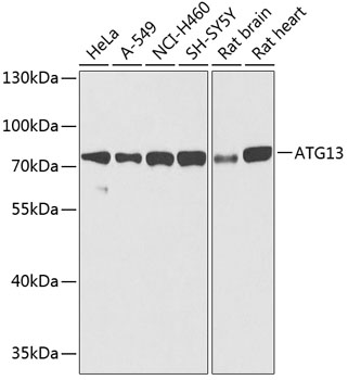 Anti-ATG13 Antibody (CAB0690)