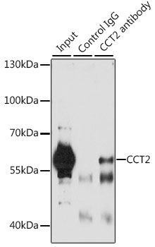 Anti-CCT2 Antibody (CAB6546)