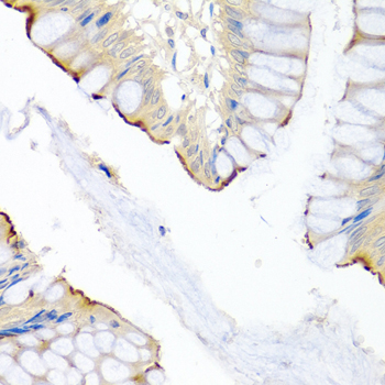 Anti-LRG1 Antibody (CAB7850)