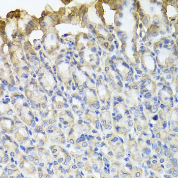 Anti-TUBB8 Polyclonal Antibody (CAB8396)