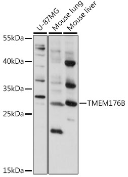 Anti-TMEM176B Antibody (CAB16118)