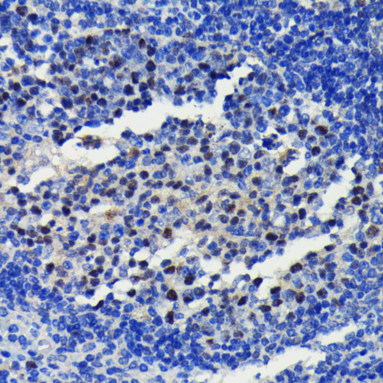 Anti-KMT6 / EZH2 Antibody [KO Validated] (CAB19577)