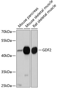 Anti-GDF2 Antibody (CAB10537)