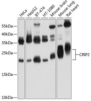 Anti-CRIP2 Polyclonal Antibody (CAB9038)