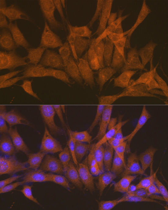 Anti-PRKACB Antibody (CAB5324)