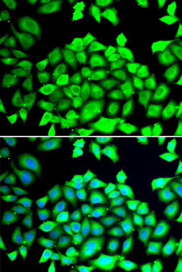 Anti-CLCN7 Antibody (CAB12422)