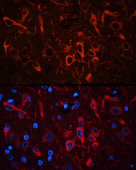 Anti-Gephyrin Polyclonal Antibody (CAB8572)