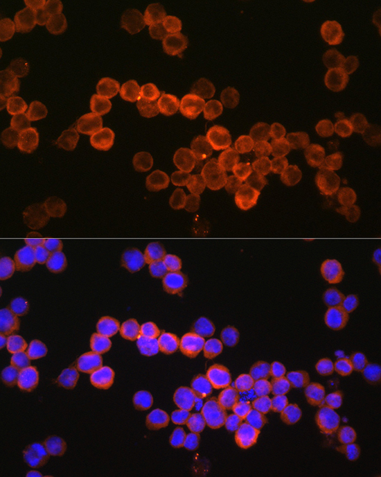 Anti-CD36 Antibody (CAB14714)