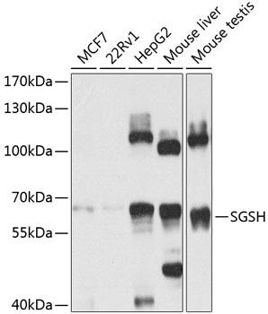 Anti-SGSH Polyclonal Antibody (CAB8148)