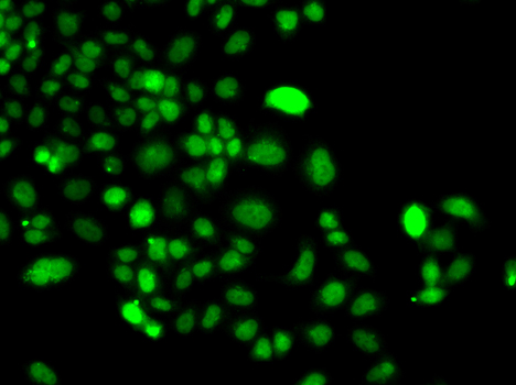 Anti-PIP4K2A Antibody (CAB7446)