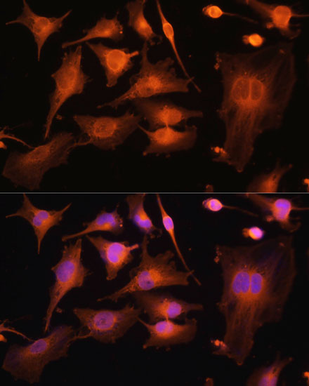 Anti-BetaIII-Tubulin Antibody [KO Validated] (CAB17074)