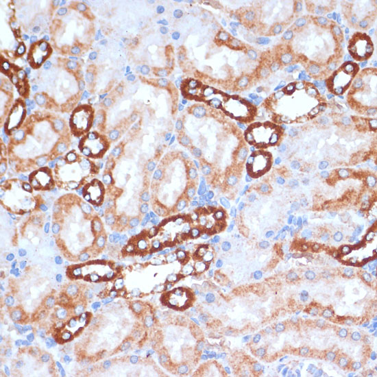 Anti-MTCO1 Antibody (CAB17889)