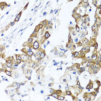 Anti-PPOX Antibody (CAB6397)