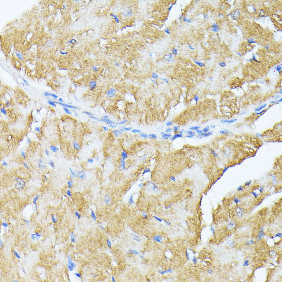 Anti-TP53I11 Antibody (CAB12855)