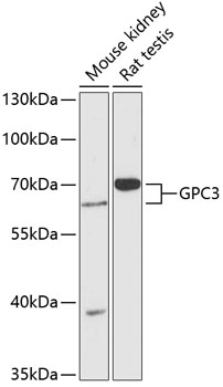 Anti-GPC3 Antibody (CAB13988)