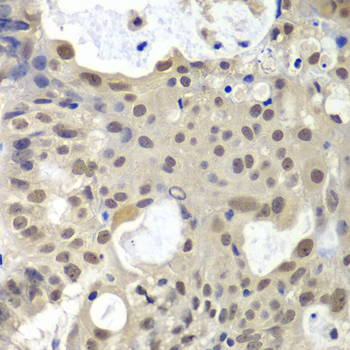 Anti-U2AF1 Antibody (CAB1046)