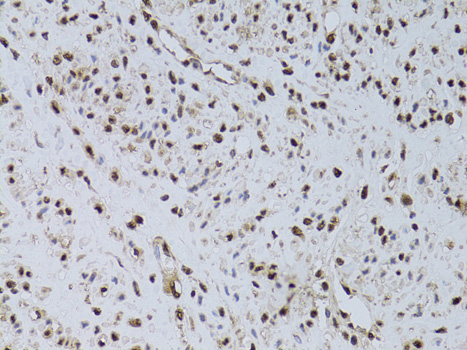 Anti-HUS1 Antibody (CAB13938)