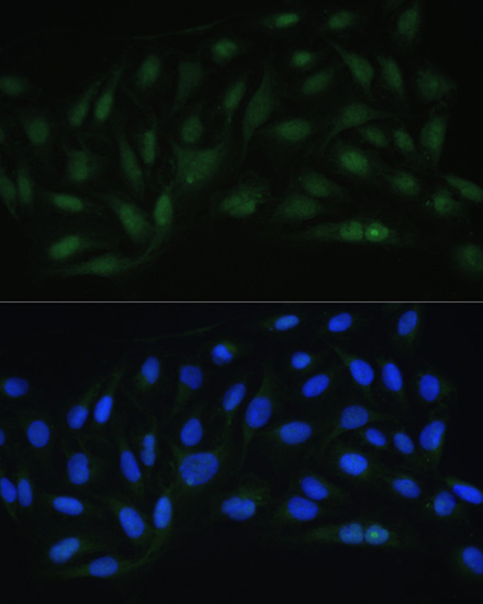 Anti-Endothelin 1 Antibody (CAB0686)