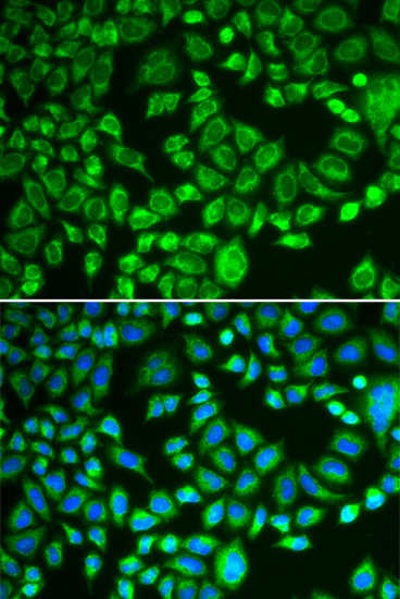 Anti-PSMD7 Antibody (CAB5356)