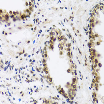 Anti-SAFB2 Antibody (CAB4330)