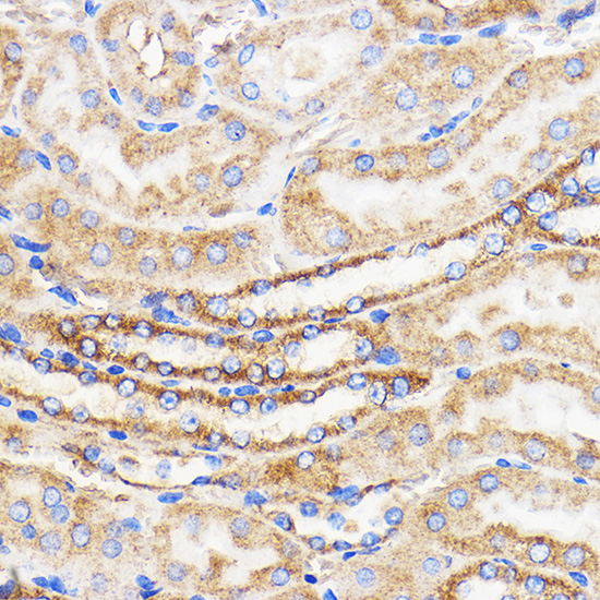 Anti-Mitofusin 2 Antibody (CAB12771)