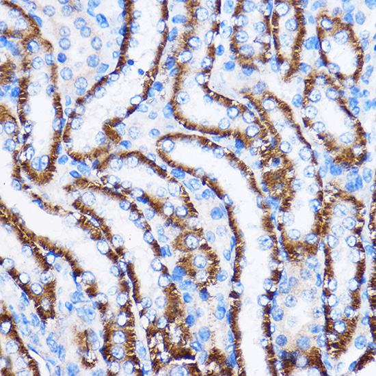 Anti-IL-23R Antibody (CAB1613)