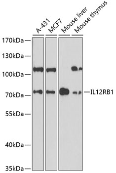 Anti-IL-12RB1 Antibody (CAB1886)