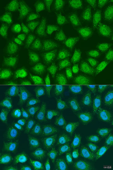 Anti-SOCS4 Polyclonal Antibody (CAB8003)