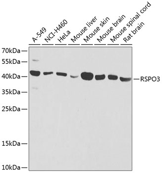 Anti-R-spondin-3 Polyclonal Antibody (CAB8389)