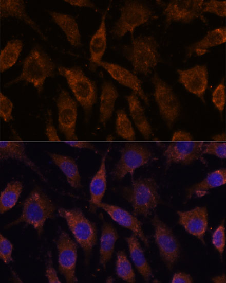 Anti-SUCLG1 Antibody (CAB15345)