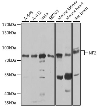 Anti-NF2 Antibody [KO Validated] (CAB0739)