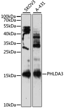 Anti-PHLDA3 Antibody (CAB12666)