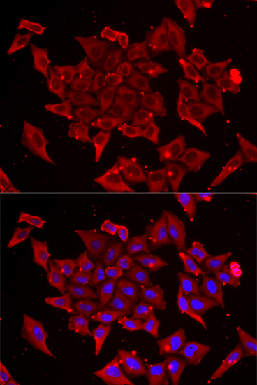 Anti-TIMM17A Antibody (CAB13578)