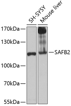 Anti-SAFB2 Antibody (CAB12550)