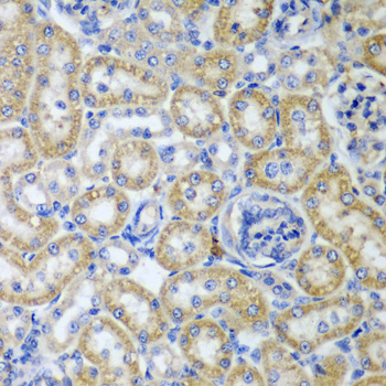 Anti-KITLG Antibody (CAB5672)