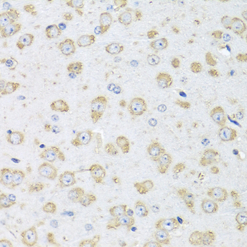 Anti-Albumin Antibody (CAB0353)