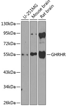 Anti-GHRHR Polyclonal Antibody (CAB8421)