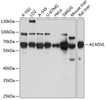 Anti-ACADVL Antibody (CAB7865)