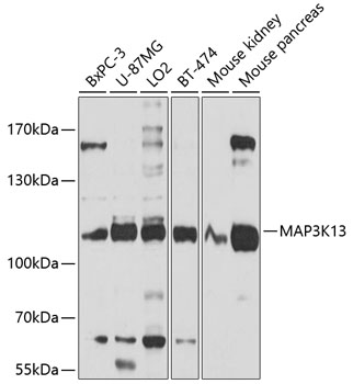 Anti-MAP3K13 Antibody (CAB10189)