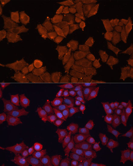 Anti-HSD17B1 Antibody (CAB10839)