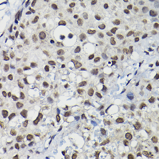 Anti-Cyclin K Antibody (CAB10261)