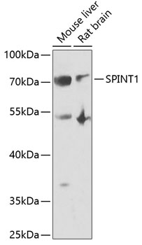 Anti-SPINT1 Antibody (CAB6411)