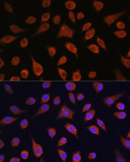 Anti-HOOK3 Antibody (CAB15536)